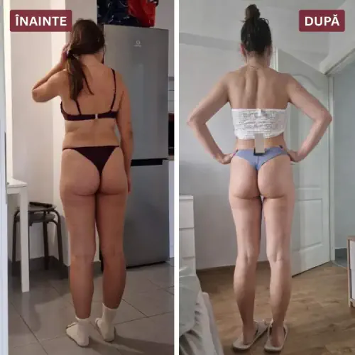 Înainte și după (Bianca)