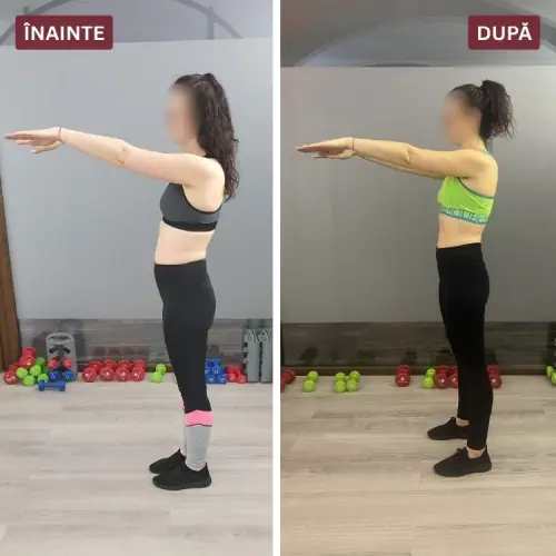 Înainte și după (Laura)