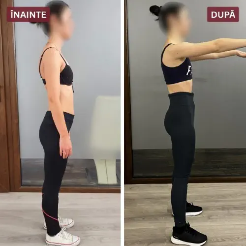 Înainte și după (Mihaela)