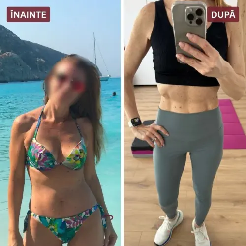 Înainte și după (Renata)